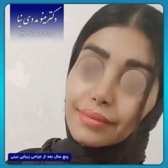 جراحی-بینی-اهواز-307