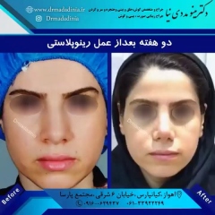 جراحی-بینی-اهواز-296