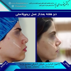 جراحی-بینی-اهواز-297