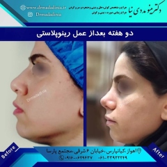 جراحی-بینی-اهواز-298