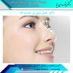 تاثیر عمل بینی بر چشم ها | دکتر مینو مددی نیا
