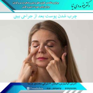 چرب شدن پوست بعد از عمل بینی