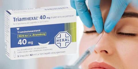 آمپول تریام هگزال بعد از عمل بینی
