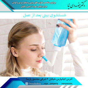 شستشوی بینی بعد از عمل