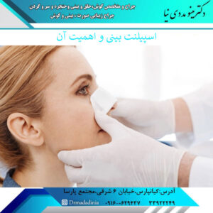 اسپیلنت بینی