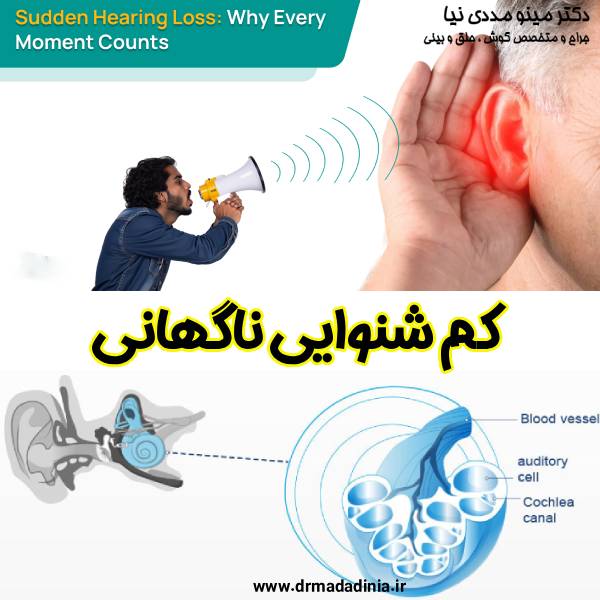 عکس کم شنوایی ناگهانی - دکتر مینو مددی نیا