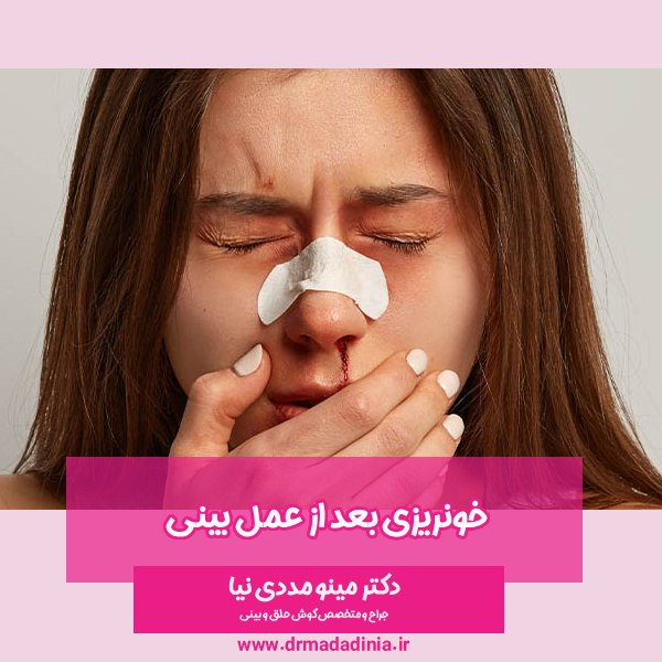 خونریزی بعد از عمل بینی