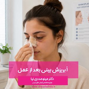 آبریزش بینی بعد از عمل
